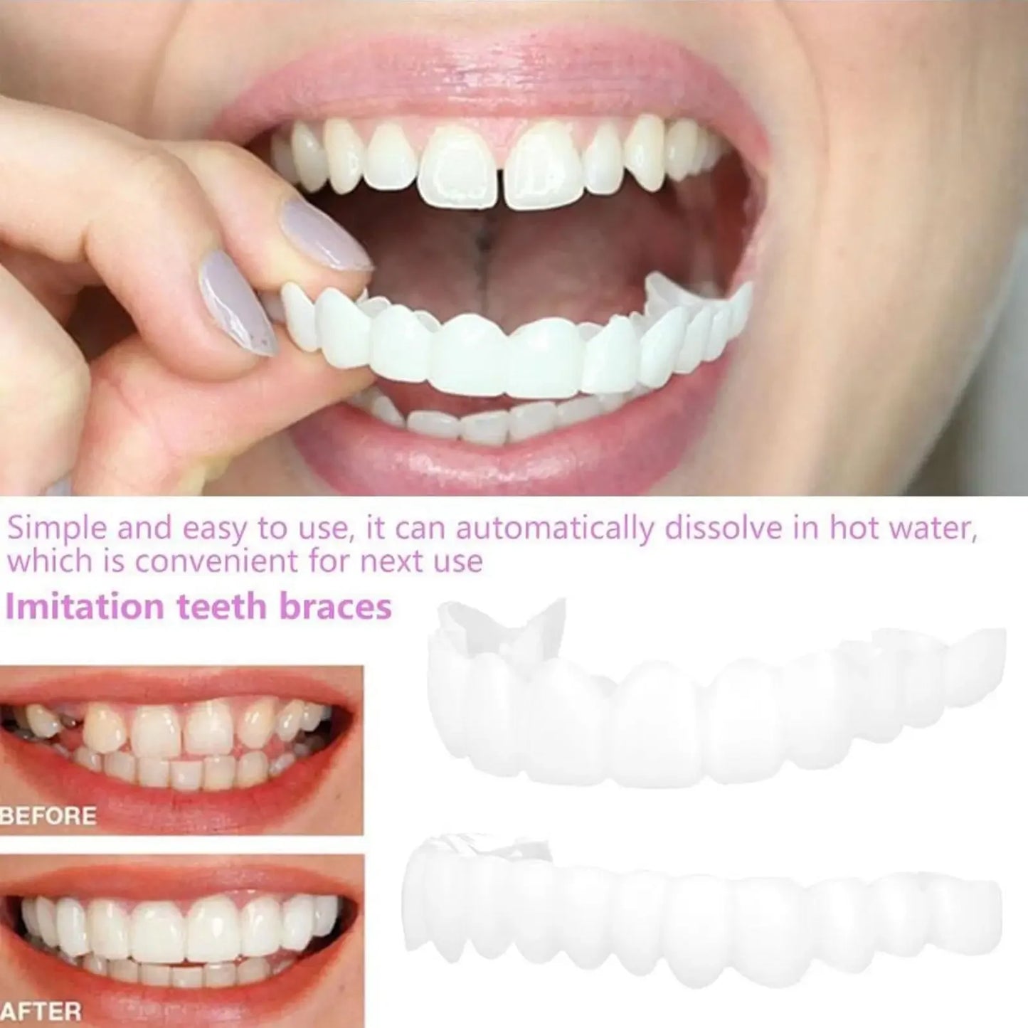Unisex Upper Lower Temporary Teeth Veneers Portable Household Oral Beauty Accessory For Daily Cosmetic Use