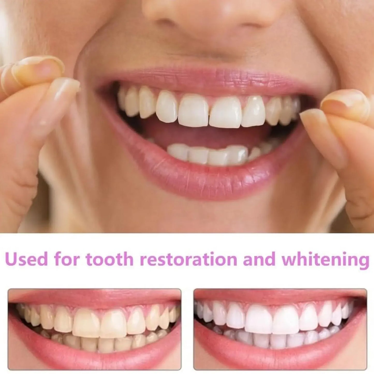 Unisex Upper Lower Temporary Teeth Veneers Portable Household Oral Beauty Accessory For Daily Cosmetic Use