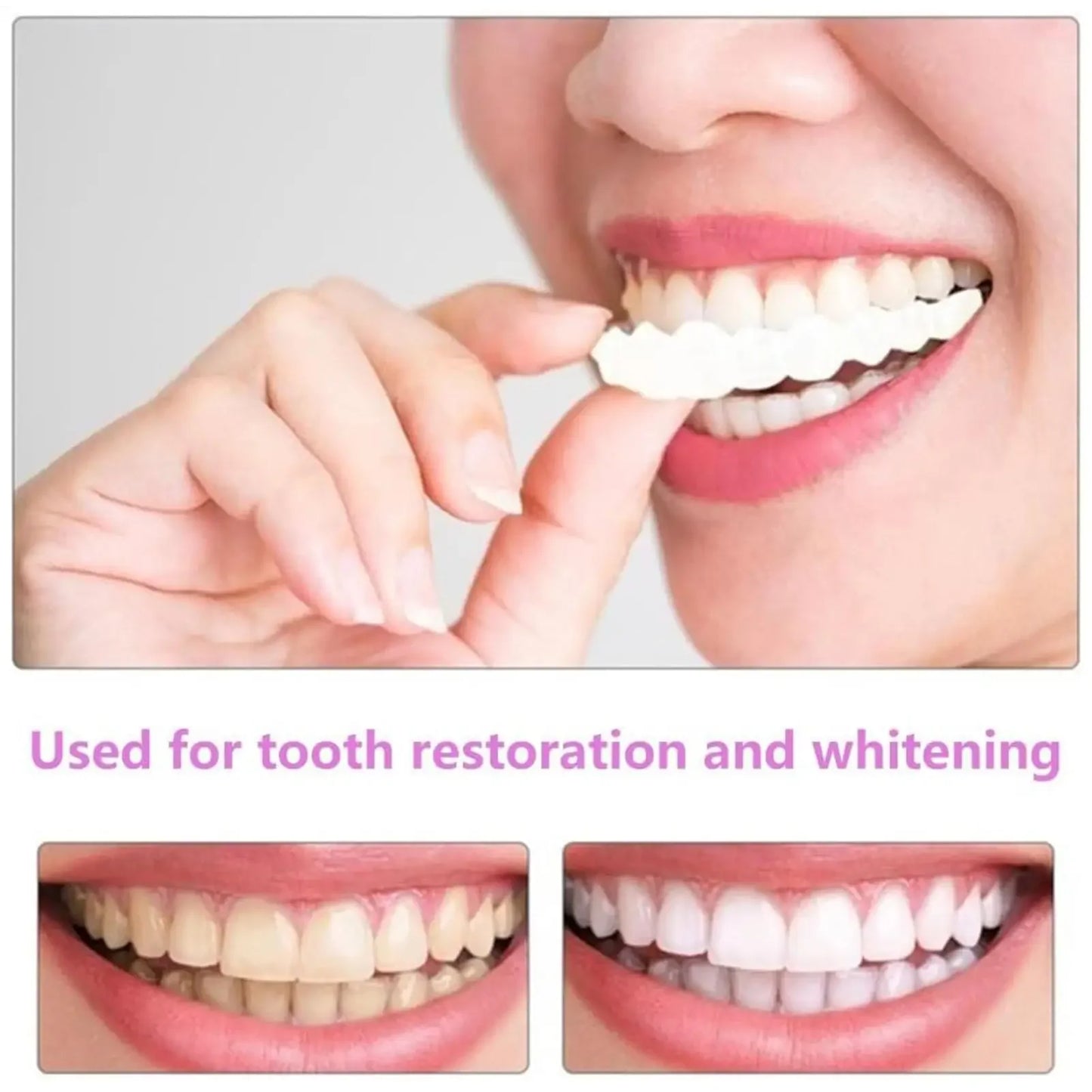 Unisex Upper Lower Temporary Teeth Veneers Portable Household Oral Beauty Accessory For Daily Cosmetic Use