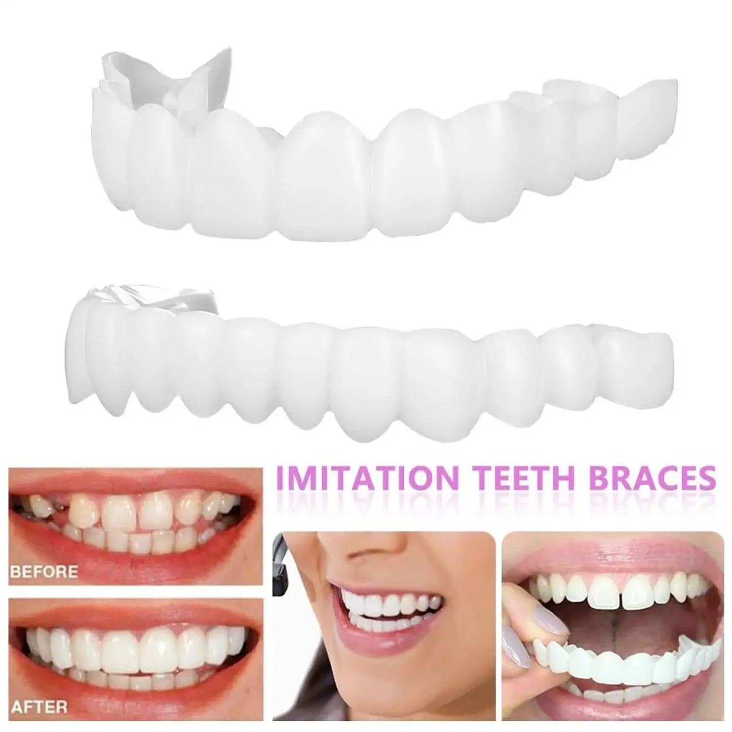 Unisex Upper Lower Temporary Teeth Veneers Portable Household Oral Beauty Accessory For Daily Cosmetic Use